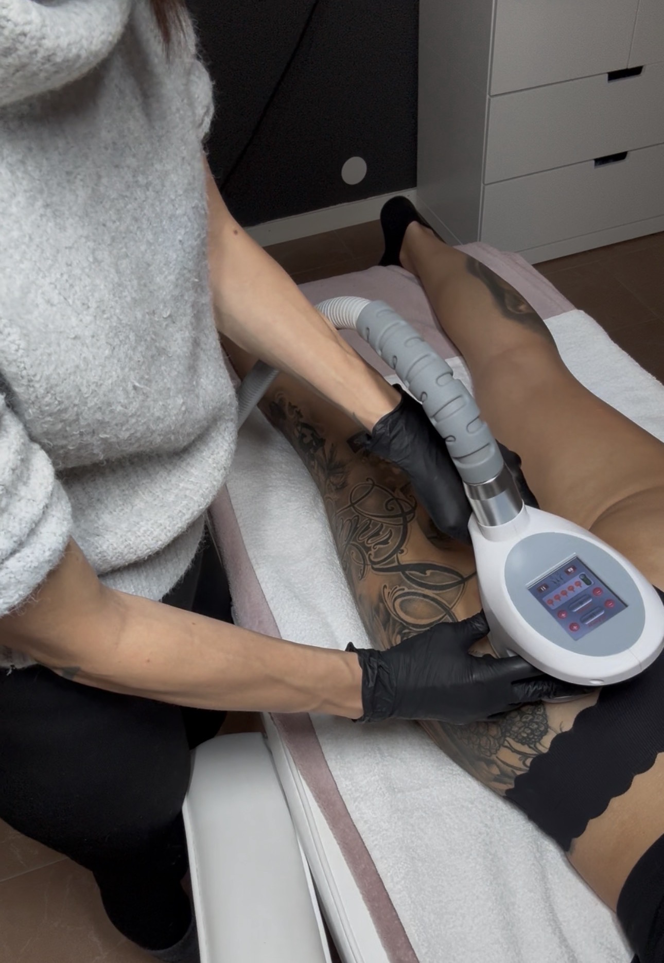 V-Shape behandling med RF-applikator