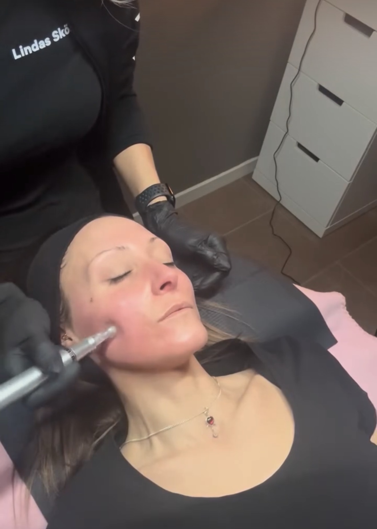 Microneedlingbehandling med professionell penna på kundens kind hos Lindas Skönhet